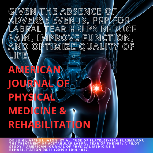 Hip Labral.phys Med.2019