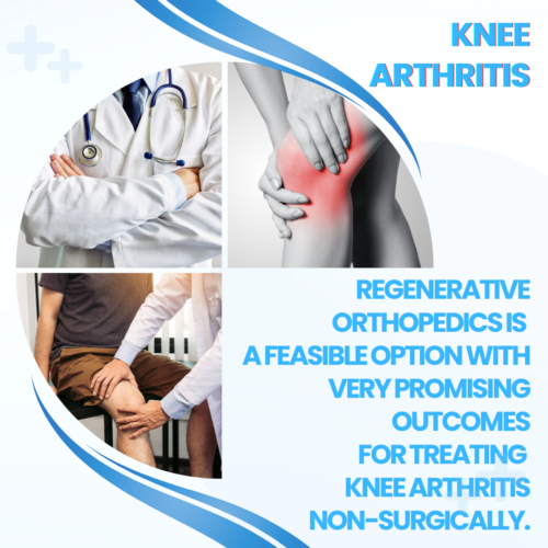 Knee Arthritis. Regen Orthop