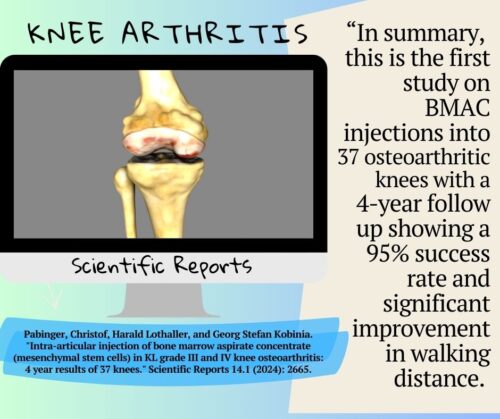 Knee Arthritis.scientific Reviews